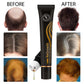 Hair Growth Products Anti Hair Loss Essential Oil Head Massage Scalp Treatments Natural Health Beauty Care